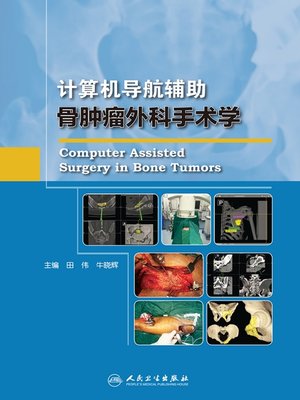 cover image of 计算机导航辅助骨肿瘤外科手术学